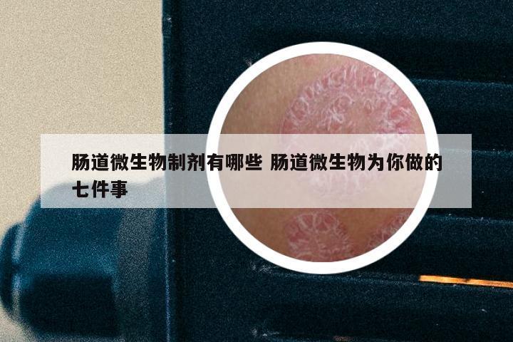 肠道微生物制剂有哪些 肠道微生物为你做的七件事