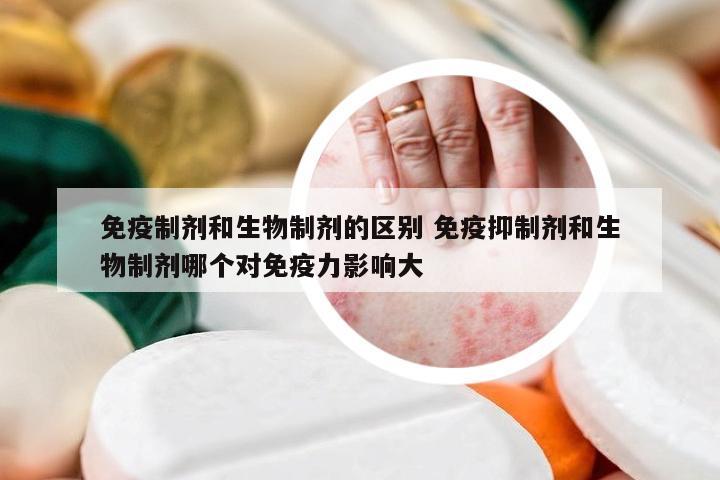 免疫制剂和生物制剂的区别 免疫抑制剂和生物制剂哪个对免疫力影响大