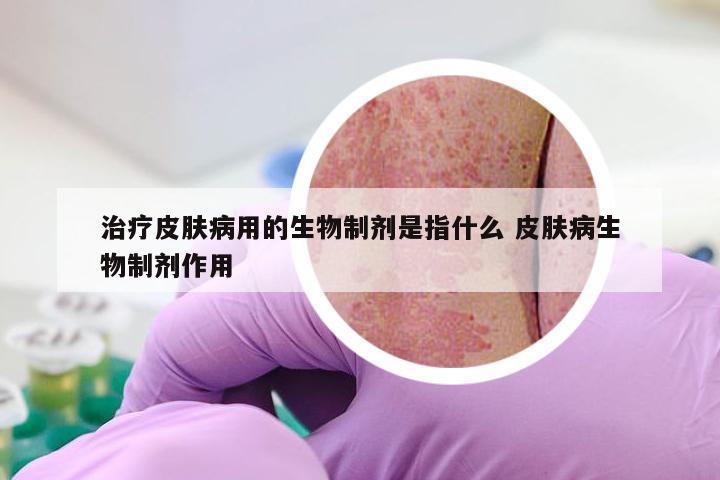 治疗皮肤病用的生物制剂是指什么 皮肤病生物制剂作用