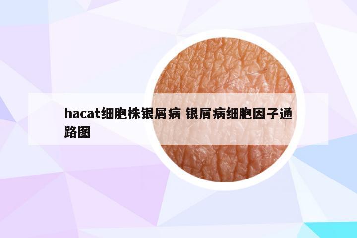 hacat细胞株银屑病 银屑病细胞因子通路图