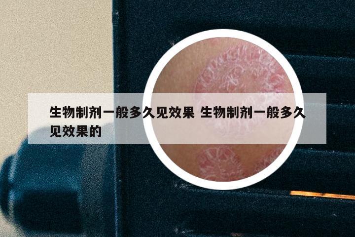 生物制剂一般多久见效果 生物制剂一般多久见效果的