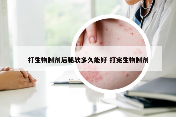 打生物制剂后腿软多久能好 打完生物制剂