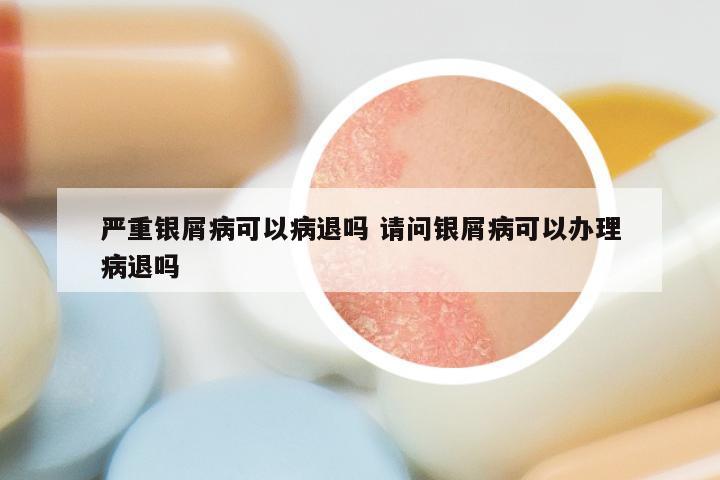 严重银屑病可以病退吗 请问银屑病可以办理病退吗