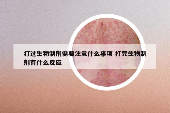 打过生物制剂需要注意什么事项 打完生物制剂有什么反应