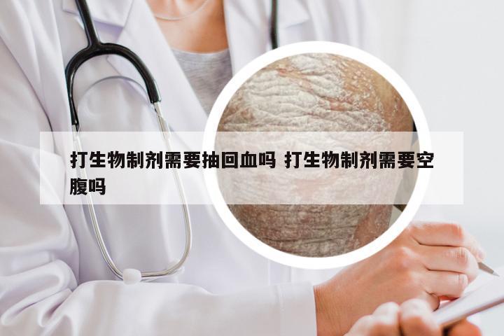 打生物制剂需要抽回血吗 打生物制剂需要空腹吗