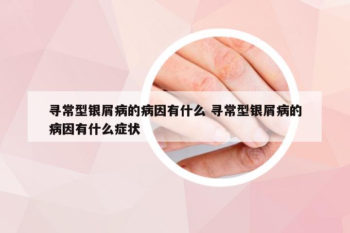 寻常型银屑病的病因有什么 寻常型银屑病的病因有什么症状