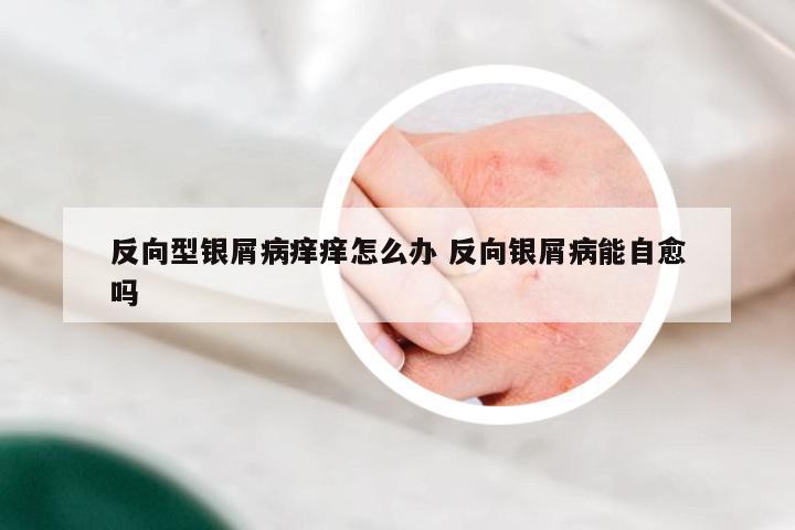 反向型银屑病痒痒怎么办 反向银屑病能自愈吗