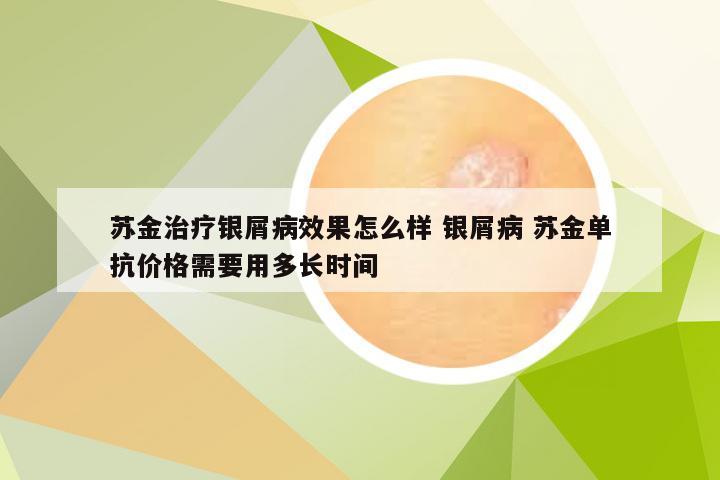 苏金治疗银屑病效果怎么样 银屑病 苏金单抗价格需要用多长时间