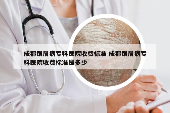 成都银屑病专科医院收费标准 成都银屑病专科医院收费标准是多少