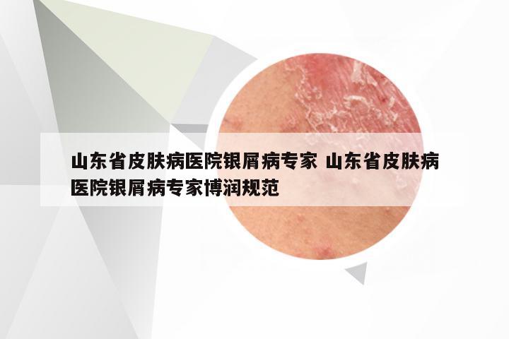 山东省皮肤病医院银屑病专家 山东省皮肤病医院银屑病专家博润规范