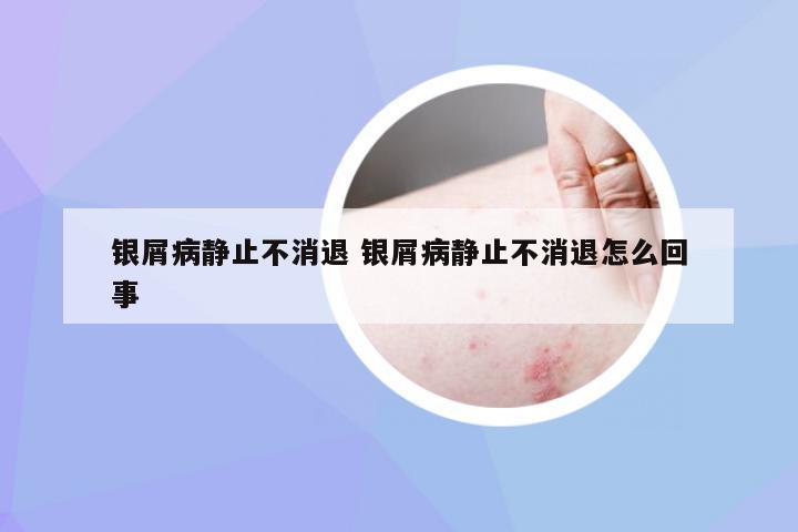 银屑病静止不消退 银屑病静止不消退怎么回事