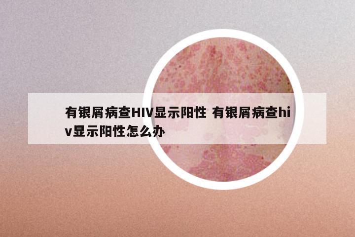 有银屑病查HIV显示阳性 有银屑病查hiv显示阳性怎么办