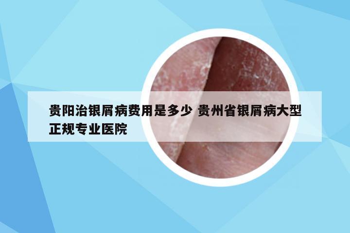 贵阳治银屑病费用是多少 贵州省银屑病大型正规专业医院