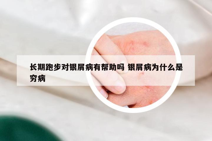 长期跑步对银屑病有帮助吗 银屑病为什么是穷病