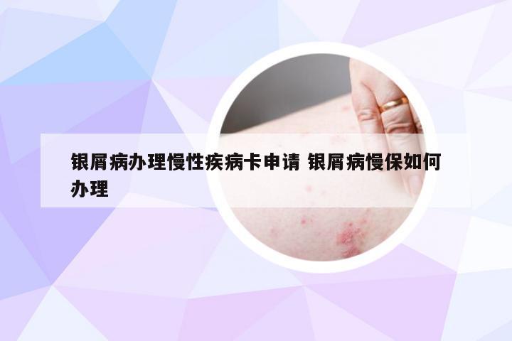 银屑病办理慢性疾病卡申请 银屑病慢保如何办理