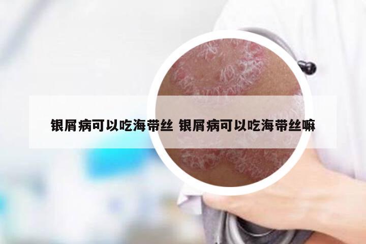 银屑病可以吃海带丝 银屑病可以吃海带丝嘛