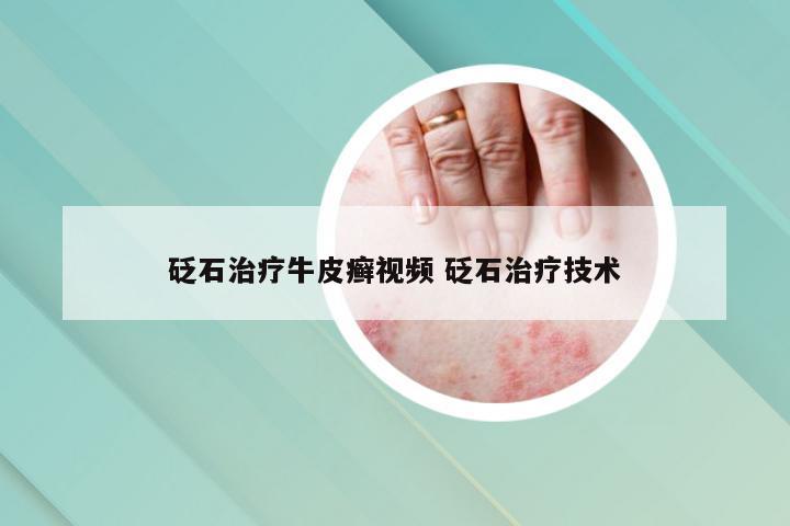 砭石治疗牛皮癣视频 砭石治疗技术