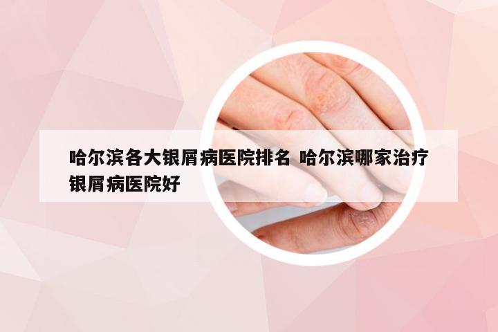 哈尔滨各大银屑病医院排名 哈尔滨哪家治疗银屑病医院好