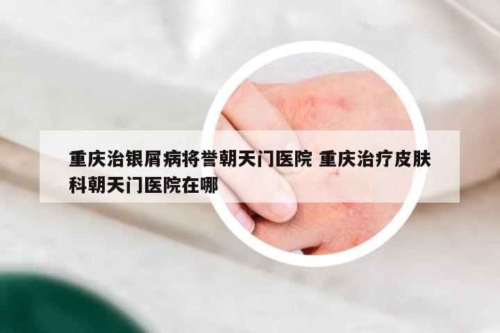 重庆治银屑病将誉朝天门医院 重庆治疗皮肤科朝天门医院在哪