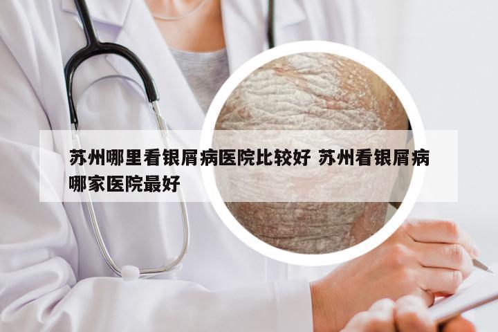 苏州哪里看银屑病医院比较好 苏州看银屑病哪家医院最好