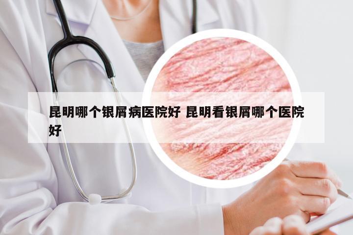 昆明哪个银屑病医院好 昆明看银屑哪个医院好