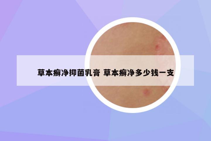 草本癣净抑菌乳膏 草本癣净多少钱一支