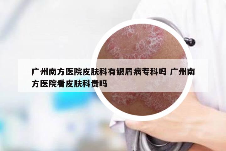 广州南方医院皮肤科有银屑病专科吗 广州南方医院看皮肤科贵吗