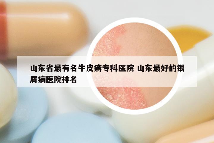 山东省最有名牛皮癣专科医院 山东最好的银屑病医院排名