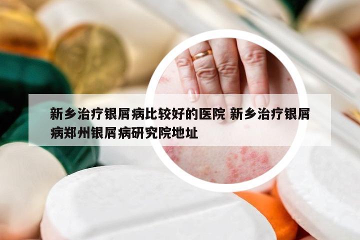 新乡治疗银屑病比较好的医院 新乡治疗银屑病郑州银屑病研究院地址