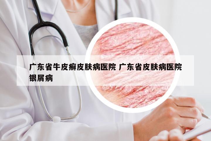 广东省牛皮癣皮肤病医院 广东省皮肤病医院银屑病