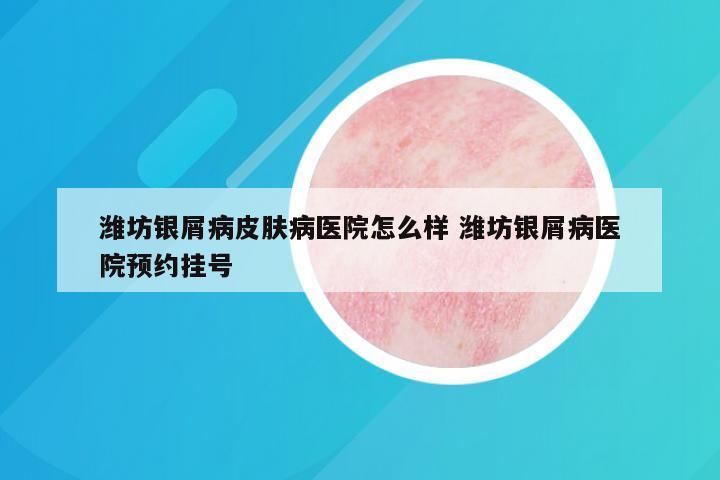 潍坊银屑病皮肤病医院怎么样 潍坊银屑病医院预约挂号