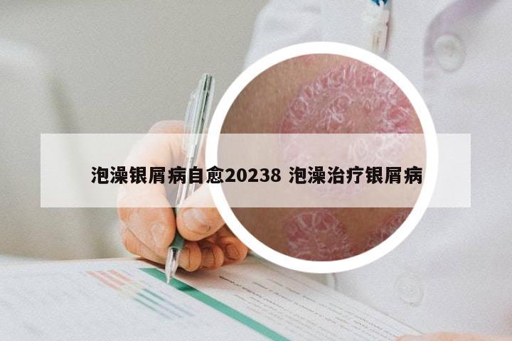 泡澡银屑病自愈20238 泡澡治疗银屑病