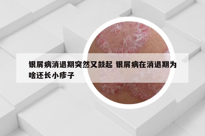 银屑病消退期突然又鼓起 银屑病在消退期为啥还长小疹子