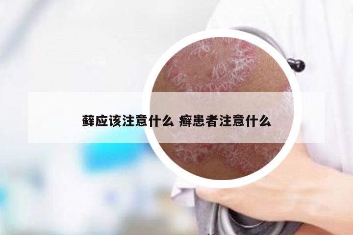 藓应该注意什么 癣患者注意什么