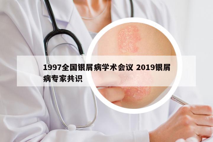 1997全国银屑病学术会议 2019银屑病专家共识