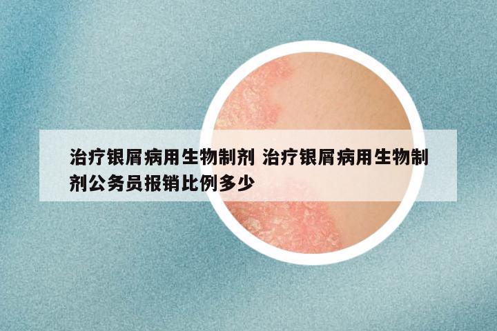 治疗银屑病用生物制剂 治疗银屑病用生物制剂公务员报销比例多少