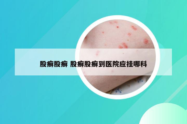 股癣股癣 股癣股癣到医院应挂哪科