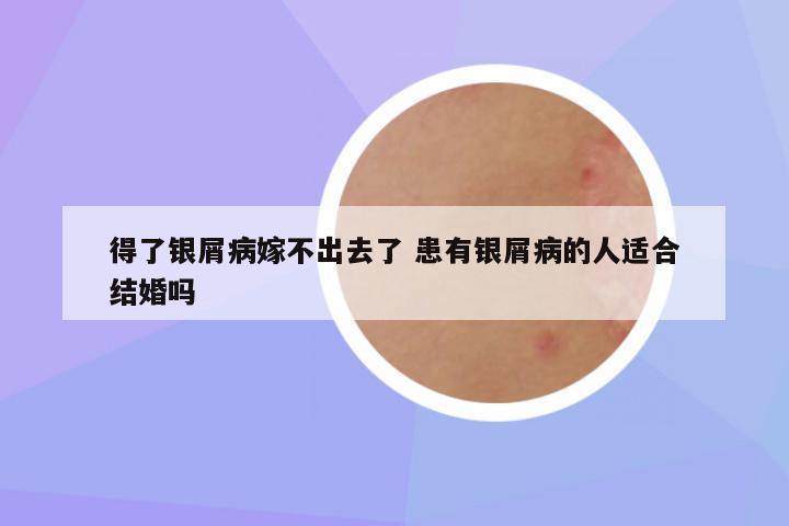 得了银屑病嫁不出去了 患有银屑病的人适合结婚吗