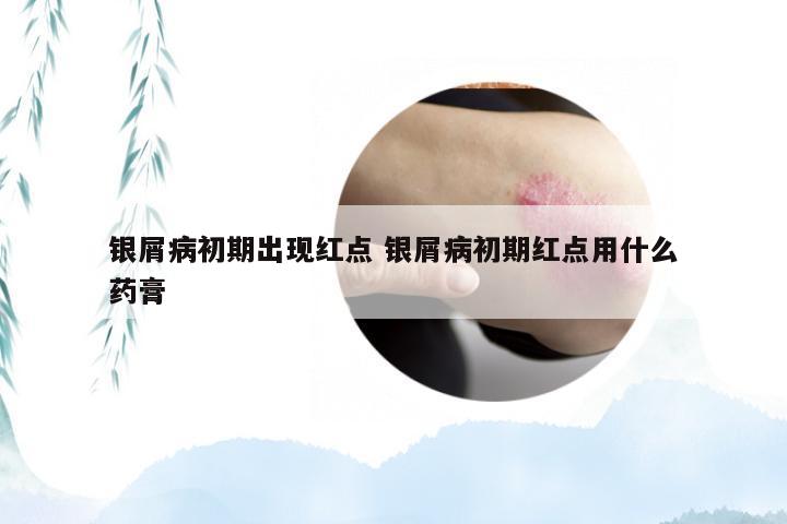 银屑病初期出现红点 银屑病初期红点用什么药膏