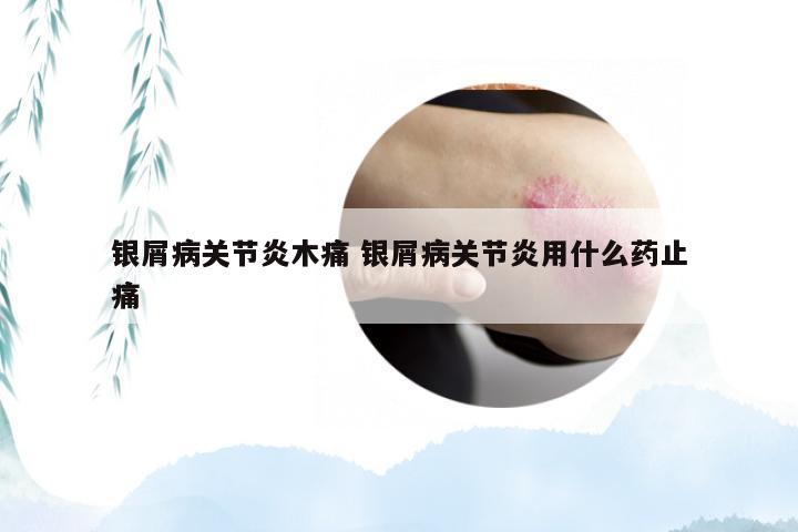 银屑病关节炎木痛 银屑病关节炎用什么药止痛