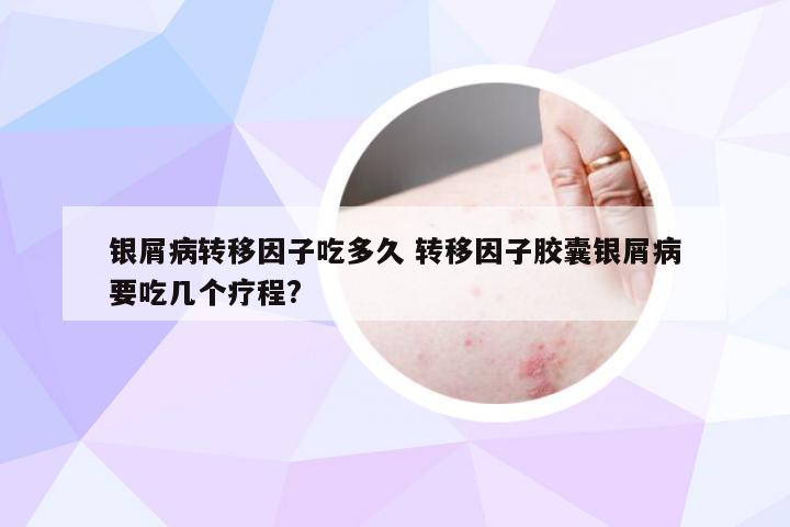 银屑病转移因子吃多久 转移因子胶囊银屑病要吃几个疗程?