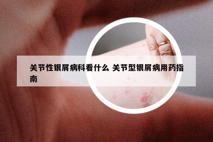 关节性银屑病科看什么 关节型银屑病用药指南