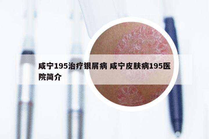 咸宁195治疗银屑病 咸宁皮肤病195医院简介