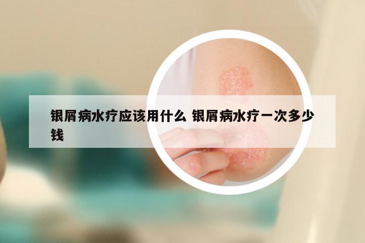 银屑病水疗应该用什么 银屑病水疗一次多少钱