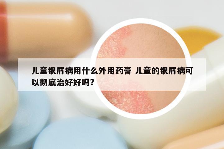 儿童银屑病用什么外用药膏 儿童的银屑病可以彻底治好好吗?