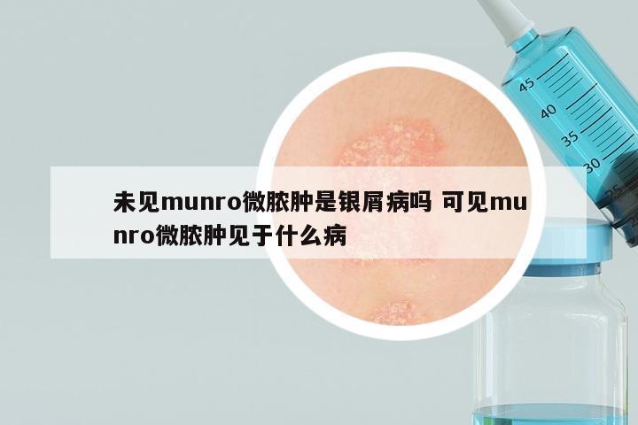 未见munro微脓肿是银屑病吗 可见munro微脓肿见于什么病