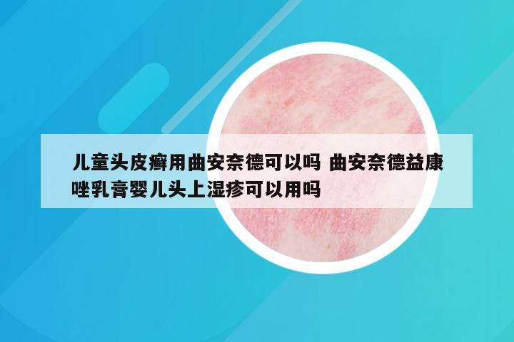 儿童头皮癣用曲安奈德可以吗 曲安奈德益康唑乳膏婴儿头上湿疹可以用吗