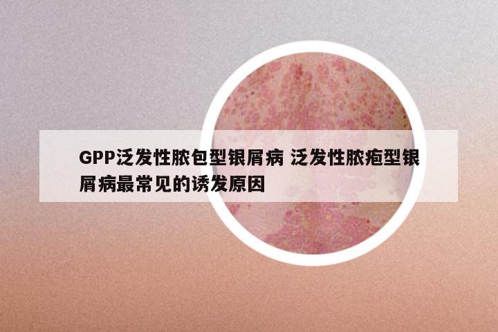 GPP泛发性脓包型银屑病 泛发性脓疱型银屑病最常见的诱发原因